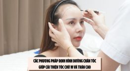Các phương pháp định hình đường chân tóc giúp cải thiện tóc chữ M và trán cao 