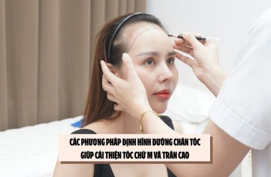 Các phương pháp định hình đường chân tóc giúp cải thiện tóc chữ M và trán cao 