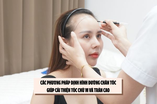 Các phương pháp định hình đường chân tóc giúp cải thiện tóc chữ M và trán cao 