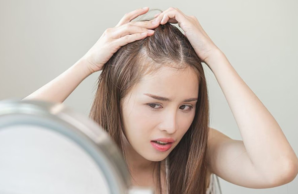 Dấu hiệu cho thấy khi nào bạn nên đi cấy tóc