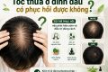 Tóc thưa hói ở đỉnh đầu có phục hồi được không?