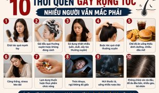 10 thói quen gây rụng tóc nhiều người vẫn mắc phải