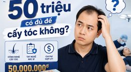 50 triệu có đủ để cấy tóc không? Tìm hiểu chi phí thực tế