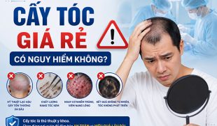 Cấy tóc giá rẻ có nguy hiểm không? Cảnh báo 6 rủi ro nghiêm trọng