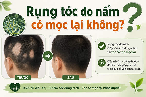 [Giải đáp] Rụng tóc do nấm có mọc lại không