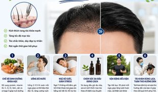 Cách giúp tóc cấy nhanh mọc theo hướng dẫn của bác sĩ
