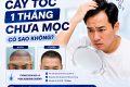 cấy tóc 1 tháng chưa mọc có sao không