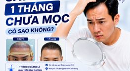 [Tìm hiểu]: Cấy tóc 1 tháng chưa mọc có sao không?