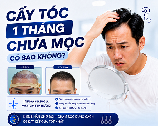 cấy tóc 1 tháng chưa mọc có sao không