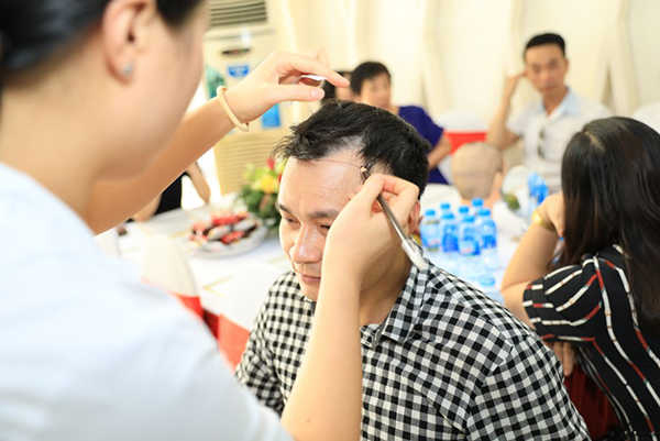 Cấy tóc cần làm mấy lần để mật độ tóc như mong muốn?