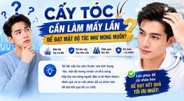 Cấy tóc cần làm mấy lần để đạt mật độ tóc như mong muốn?