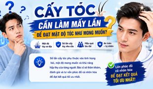 Cấy tóc cần làm mấy lần để đạt mật độ tóc như mong muốn?