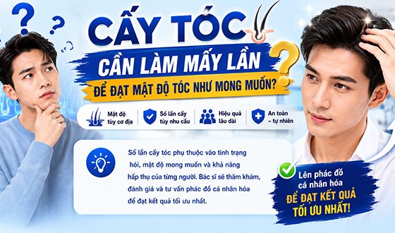 Cấy tóc cần làm mấy lần để mật độ tóc như mong muốn?