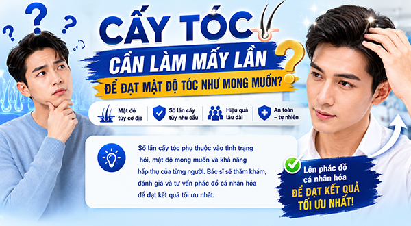Cấy tóc cần làm mấy lần để mật độ tóc như mong muốn?