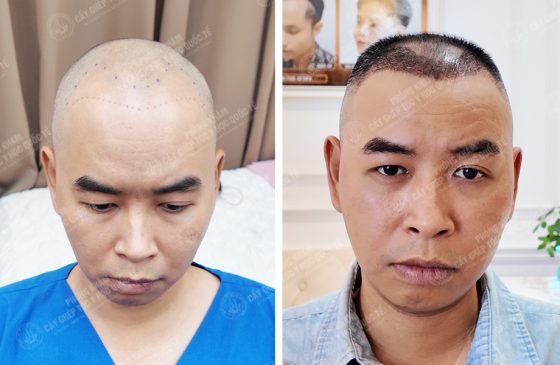 Nguyễn Đức Anh