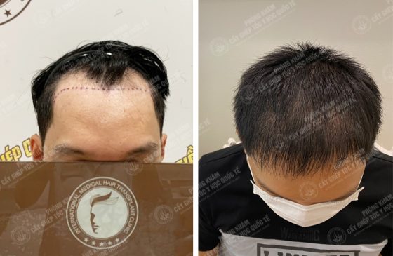 Vũ Xuân Việt