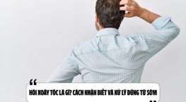 Hói xoáy tóc là gì? Cách nhận biết và xử lý đúng từ sớm