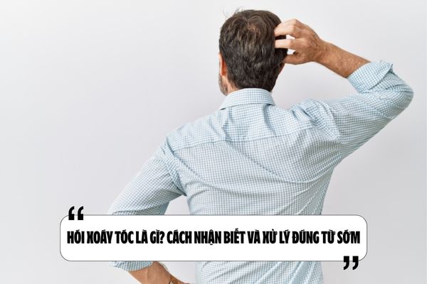 Hói xoáy tóc là gì? Cách nhận biết và xử lý đúng từ sớm