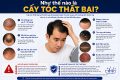 Như thế nào là cấy tóc thất bại? 7 dấu hiệu cảnh báo không nên chủ quan