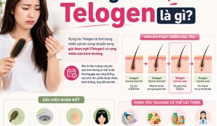 Rụng tóc Telogen là gì? Dấu hiệu nhận biết, nguyên nhân và cách cải thiện hiệu quả