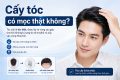 Cấy tóc có mọc thật không?