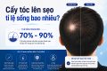 Cấy tóc lên sẹo tỉ lệ sống bao nhiêu