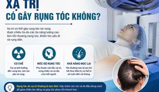 Xạ trị có gây rụng tóc không? Nguyên nhân và khả năng phục hồi tóc sau xạ trị