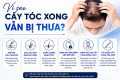 Vì sao cấy tóc xong vẫn bị thưa? 6 nguyên nhân nên biết