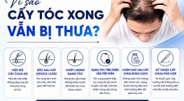 Vì sao cấy tóc xong vẫn bị thưa? 6 nguyên nhân nên biết