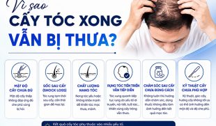 Vì sao cấy tóc xong vẫn bị thưa? 6 nguyên nhân nên biết
