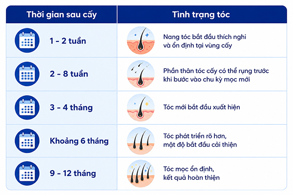 Bao lâu sau cấy tóc mới đạt mật độ ổn định