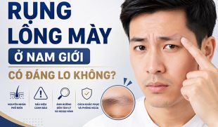 Rụng lông mày ở nam giới có đáng lo không? Có khắc phục được không?
