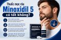 [Giải đáp]: Thuốc mọc râu Minoxidil 5 có tốt không?