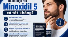 [Giải đáp]: Thuốc mọc râu Minoxidil 5 có tốt không?