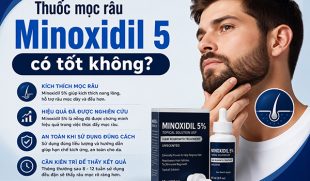 [Giải đáp]: Thuốc mọc râu Minoxidil 5 có tốt không?