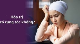 [Tìm hiểu]: Hoá trị có rụng tóc không?