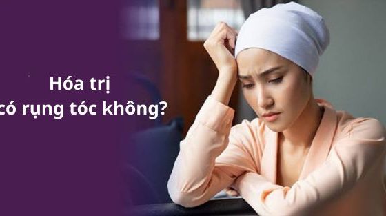 [Tìm hiểu]: Hoá trị có rụng tóc không?