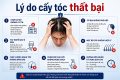 Lý do cấy tóc thất bại: 7 nguyên nhân cần biết trước khi thực hiện