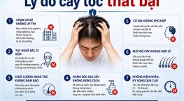 Lý do cấy tóc thất bại: 7 nguyên nhân cần biết trước khi thực hiện
