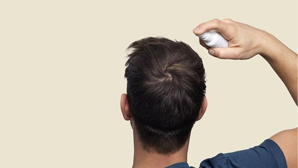 Dùng Minoxidil lâu dài có an toàn không?