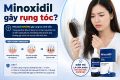 Minoxidil gây rụng tóc? 3 nguyên nhân thường gặp và cách xử lý đúng