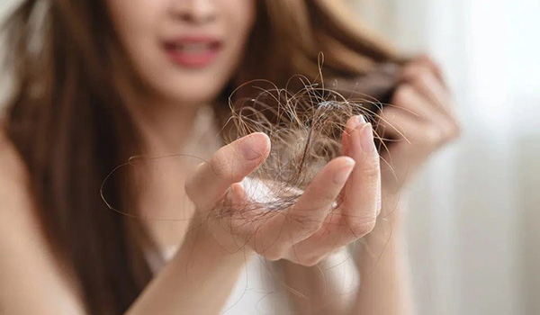 Vì sao tóc rụng nhiều hơn khi mới dùng Minoxidil?