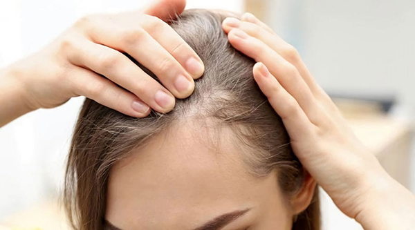 Trường hợp nào nên cấy tóc mai và trường hợp nào cần cân nhắc?
