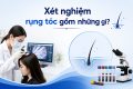 Xét nghiệm rụng tóc gồm những gì Thực hiện ở đâu
