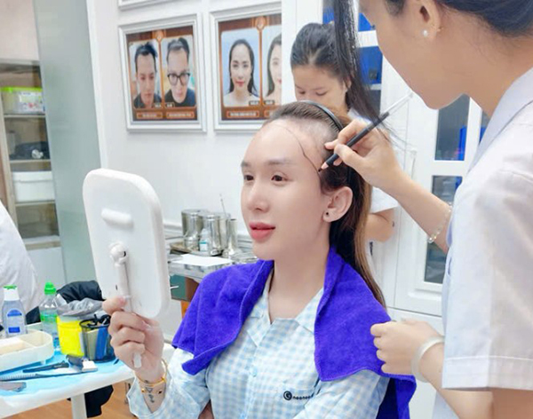 quy trình cấy tóc trên sẹo