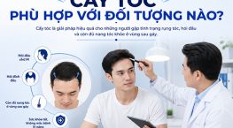 Cấy tóc phù hợp với đối tượng nào? Ai nên và chưa nên thực hiện?
