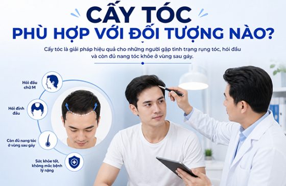Cấy tóc phù hợp với đối tượng nào?
