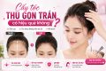 [Tìm Hiểu] : Cấy tóc thu gọn trán có hiệu quả không?