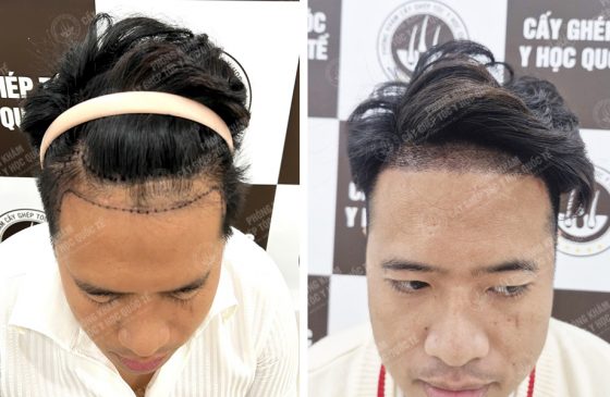 Trần Hoàng Linh