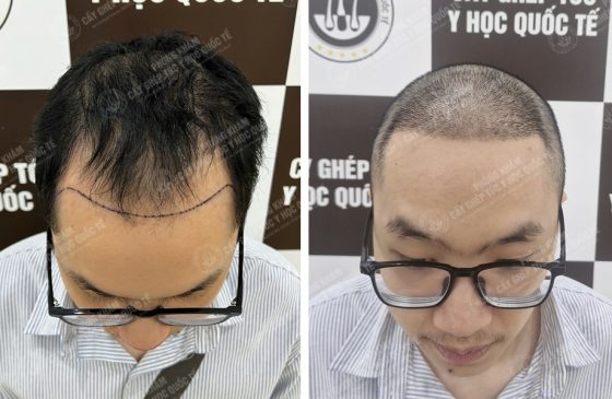 Lý Văn Sinh